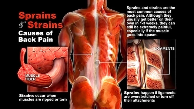 Muscle or Ligament Injury