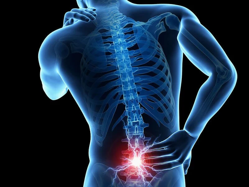 low back pain